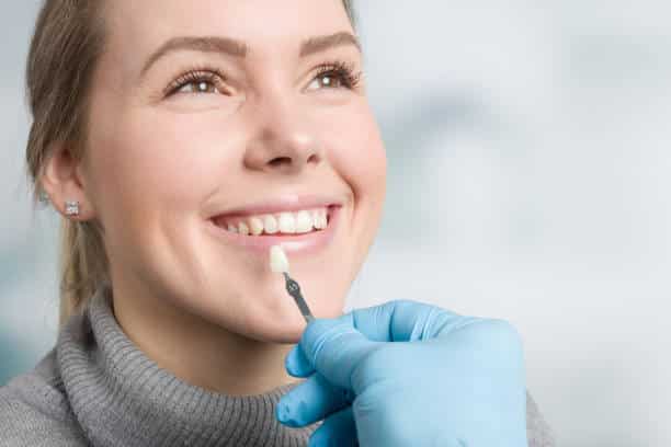 veneers